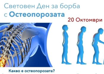Консултират безплатно бургазлии за риска от остеопороза