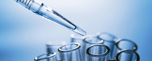 Изследват симитличани за хронични незаразни болести 1 lab testing