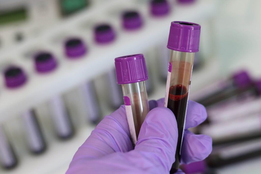 Мутиралият вирус бил у нас още през април 1 laboratory 3827736 1920 11