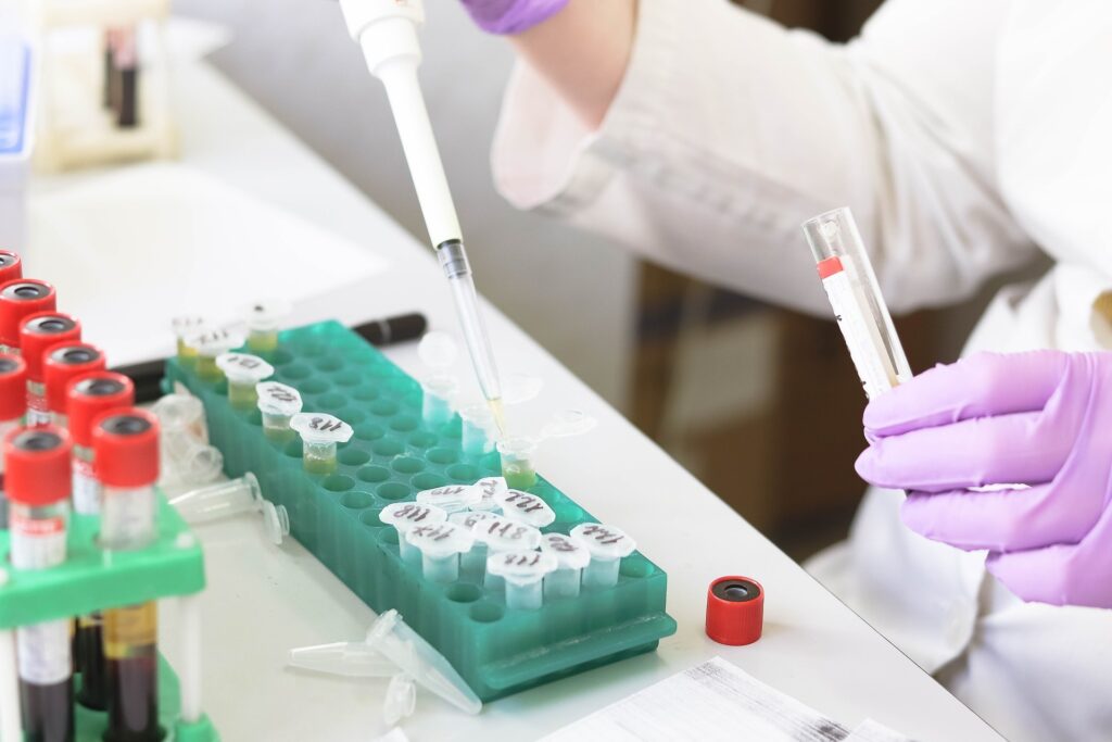 Масово тестване за коронавирус в забавачки 1 laboratory 3827738 1920 25