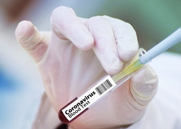 Великобритания осигури ранен достъп до 90 млн. ваксини срещу COVID-19 1 vaccine 4946480 1920