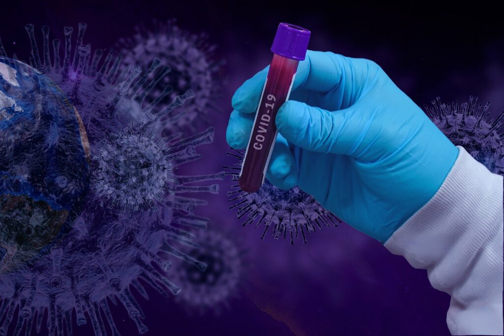 COVID - 19 най-вероятно е създаден в лаборатория, твърди учен от Харвард 1 covid 19 gd2ac9fe6b 1920