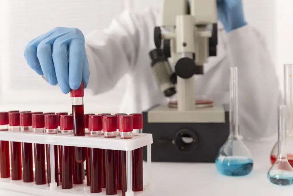coronavirus blood samples arrangement lab 354e3980